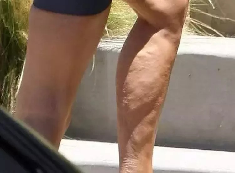 #